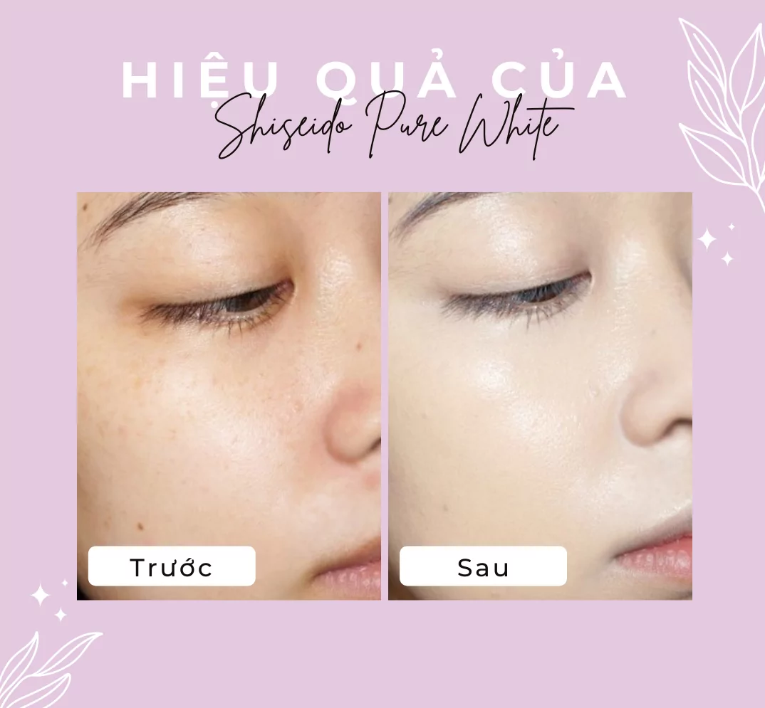 hieu-qua-cua-shiseido-pure-white hieu qua cua shiseido pure white