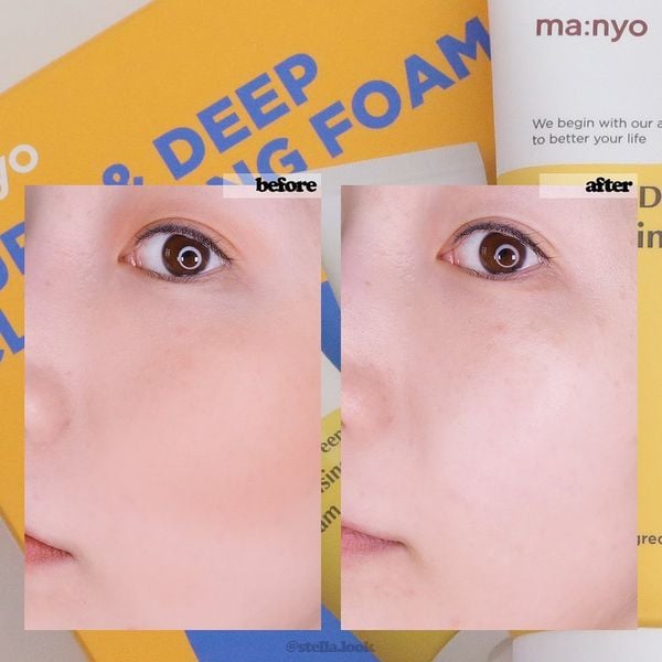 Hình ảnh sản phẩm