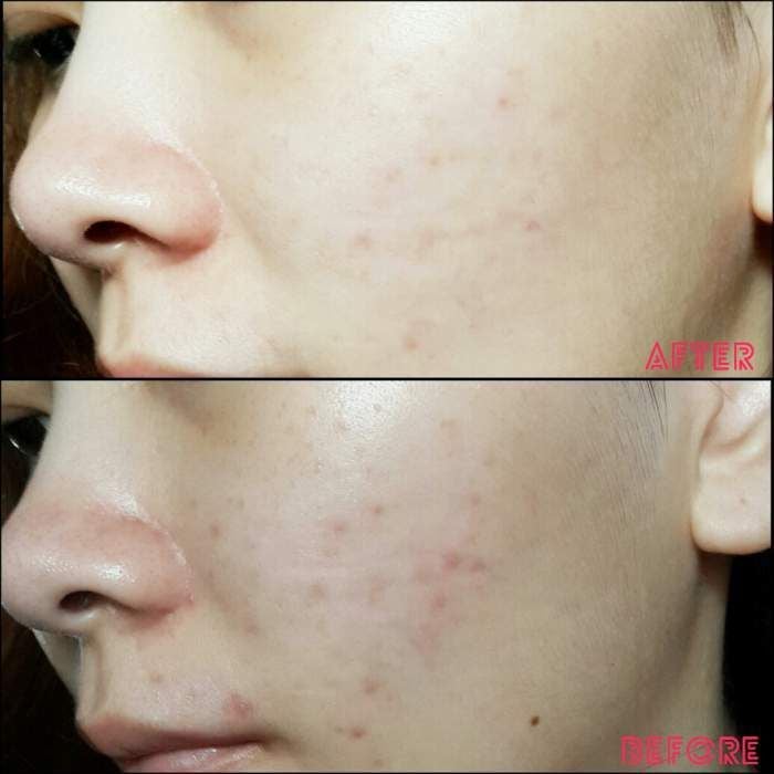 Tinh Chất Estée Lauder Advanced Night Repair 15ML 4 tinh chat estee lauder advanced night repair 15ml 2566 3