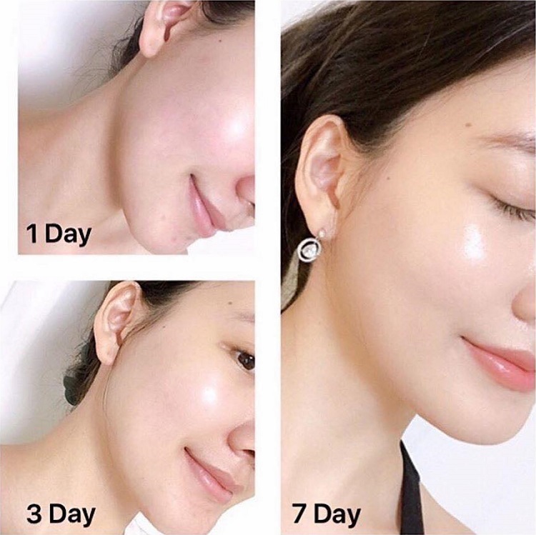 Set kem dưỡng Olay Total Effects 7 in 1 ngày và đêm